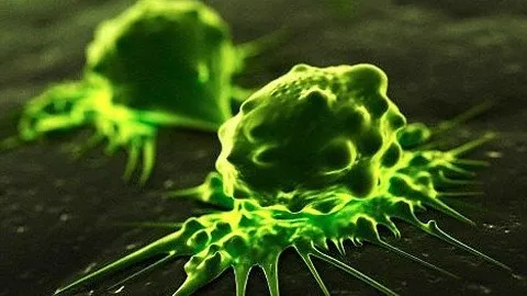 Chữa ung thư bằng công nghệ nano từ tính